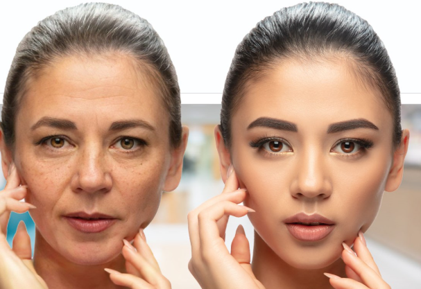 Best one Botox in  Mississauga 